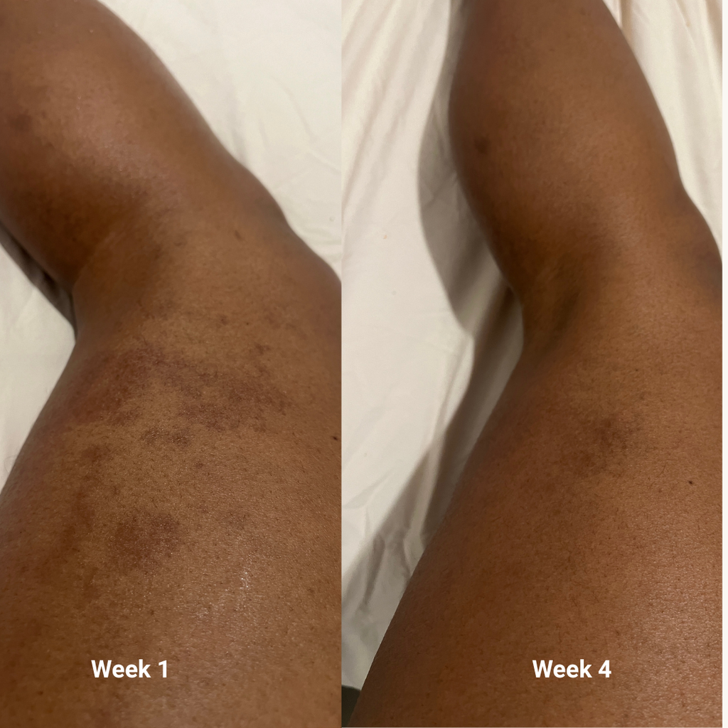 Derm Intellect Dark Spot Serum