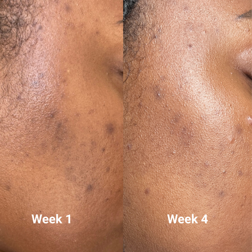 Derm Intellect Dark Spot Serum
